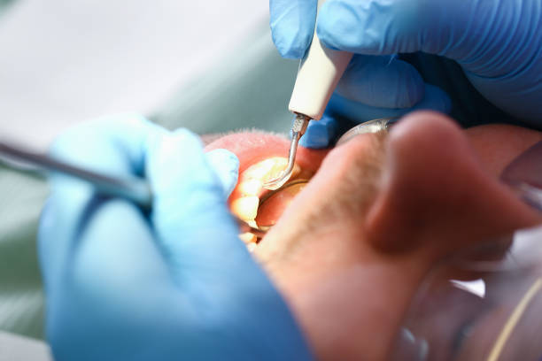 Best Root Canal Emergency Dentist  in Constantine, MI