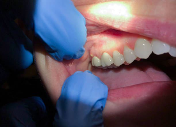 Best Chipped Tooth Repair Near Me  in Constantine, MI