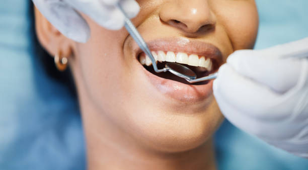 Best Dentist for Tooth Abscess  in Constantine, MI