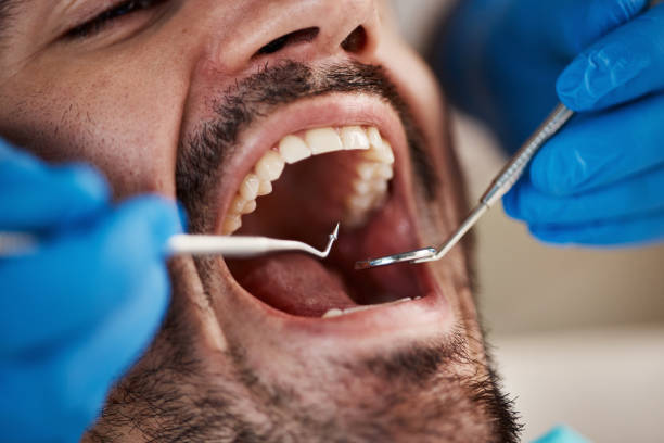 Best Broken Tooth Emergency  in Constantine, MI