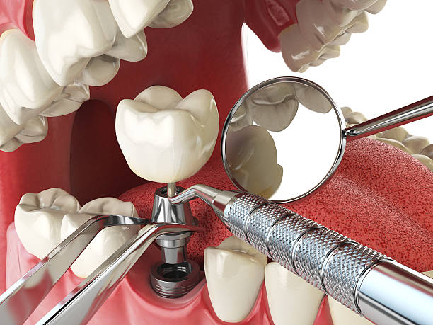 Best Tooth Pain Emergency Relief  in Constantine, MI